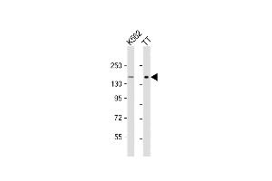 All lanes : Anti-c-KIT Antibody (C-term) at 1:1000 dilution Lane 1: K562 whole cell lysate Lane 2: TT whole cell lysate Lysates/proteins at 20 μg per lane. (KIT anticorps  (AA 912-941))