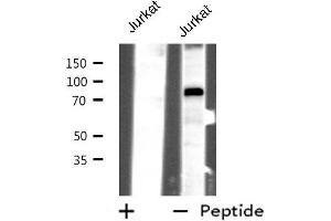 Western blot analysis of extracts from Jurkat cells, using CHFR antibody.