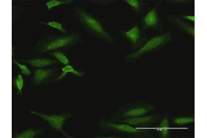 Immunofluorescence of purified MaxPab antibody to DYRK1B on HeLa cell.