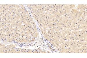 Detection of NOTCH2 in Human Liver Tissue using Polyclonal Antibody to Notch Homolog 2 (NOTCH2) (NOTCH2 anticorps  (AA 2251-2466))