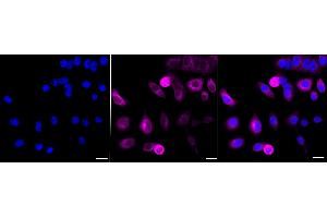 Immunocytochemical staining of HepG2 cells with Cyclin B1 antibody (ABIN7798191), 1:1,000). (Recombinant Cyclin B1 anticorps)
