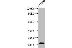 Western Blot Positive WB detected in: HEK293 whole cell lysate All lanes: ATF3 antibody at 3 μg/mL Secondary Goat polyclonal to rabbit IgG at 1/50000 dilution Predicted band size: 21, 14, 16, 13, 15 kDa Observed band size: 21 kDa (ATF3 anticorps  (AA 1-181))