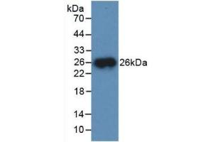 Detection of Recombinant CTSB, Mouse using Polyclonal Antibody to Cathepsin B (CTSB) (Cathepsin B anticorps  (AA 129-333))