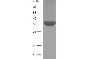 Western Blotting (WB) image for Protein Phosphatase 1, Regulatory Subunit 8 (PPP1R8) (AA 1-351) protein (His-IF2DI Tag) (ABIN7124669)