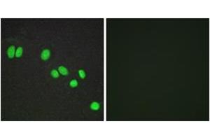 Immunofluorescence analysis of A549 cells, using NCOR2 Antibody. (NCOR2 anticorps  (AA 511-560))