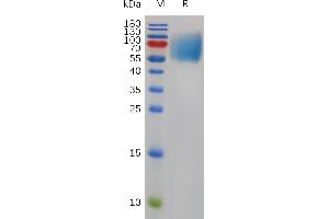 Mouse SIRPA Protein, His Tag on SDS-PAGE under reducing condition.