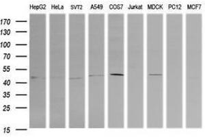 Image no. 3 for anti-Parvin, alpha (PARVA) antibody (ABIN1496443)