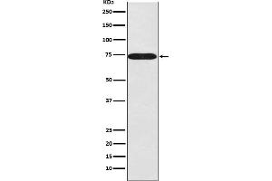 Western blot analysis of SNX1 expression in 293T cell lysate.