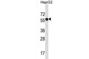 Western Blotting (WB) image for anti-Carboxypeptidase N Subunit 2 (CPN2) antibody (ABIN2997205)
