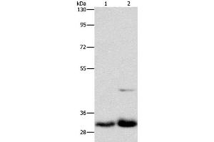 Western Blot analysis of Lovo and PC3 cell using MPG Polyclonal Antibody at dilution of 1:950 (MPG anticorps)