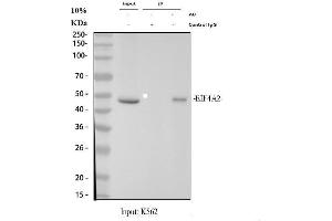 anti-Eukaryotic Translation Initiation Factor 4A2 (EIF4A2) (AA 5-31), (N-Term) antibody