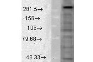 Cav1. (CACNA1D anticorps  (AA 859-875))