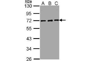 WB Image Sample(30 ug whole cell lysate) A:Hep G2 , B:MOLT4 , C:Raji , 10% SDS PAGE antibody diluted at 1:5000