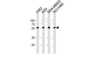 Western Blotting (WB) image for anti-Nuclear Pore Complex Interacting Protein-Like 2 (NPIPL2) antibody (ABIN3004718) (NPIPL2 anticorps)