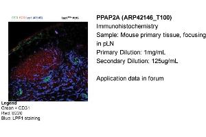 Sample Type: Mouse primary tissue, focusing in pLNPrimary Dilution: 1mg/mLSecondary Dilution: 125ug/mL