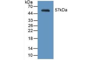 Detection of Recombinant MYH2, Mouse using Polyclonal Antibody to Myosin Heavy Chain 2 (MYH2)