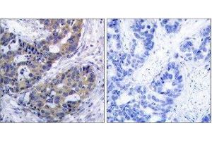 Immunohistochemistry (IHC) image for anti-Insulin Receptor Substrate 1 (IRS1) (Ser312) antibody (ABIN1848112) (IRS1 anticorps  (Ser312))