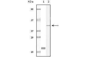 Western blot analysis using CIB1 mouse mAb against truncated CIB1 recombinant protein (1) and A431 cell lysate (2). (CIB1 anticorps)