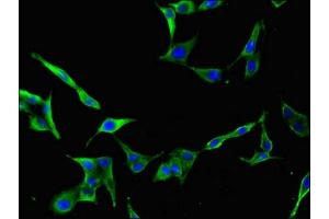 Immunofluorescent analysis of Hela cells using ABIN7158853 at dilution of 1:100 and Alexa Fluor 488-congugated AffiniPure Goat Anti-Rabbit IgG(H+L)