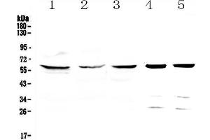 Western blot analysis of TCP1 eta using anti-TCP1 eta antibody . (CCT7 anticorps  (AA 30-307))
