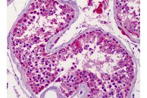 Human Testis: Formalin-Fixed, Paraffin-Embedded (FFPE)