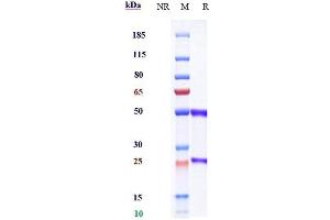 anti-VEGFR2 (Olinvacimab Biosimilar) antibody