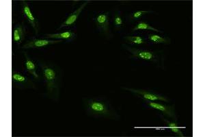 Immunofluorescence of purified MaxPab antibody to ZNF668 on HeLa cell.