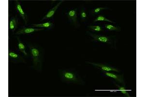 Immunofluorescence of purified MaxPab antibody to ZNF668 on HeLa cell. (ZNF668 anticorps  (AA 1-619))
