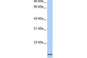 CCNL2 antibody used at 0. (Cyclin L2 anticorps  (N-Term))
