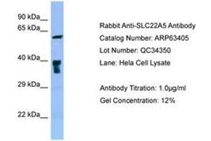 Image no. 1 for anti-Solute Carrier Family 22 Member 5 (SLC22A5) (C-Term) antibody (ABIN6749981) (SLC22A5 anticorps  (C-Term))