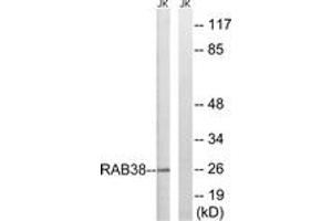 Western blot analysis of extracts from Jurkat cells, using RAB38 Antibody. (RAB38 anticorps  (AA 80-129))
