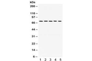 Western blot testing of 1) rat brain, 2) mouse stomach, human 3) HeLa, 4) U87 and 5) SKOV lysate with LIMK antibody. (LIM Domain Kinase 1 anticorps)