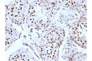 Formalin-fixed, paraffin-embedded human Testicular Carcinoma stained with Histone H1 Mouse Monoclonal Antibody (AE-4)