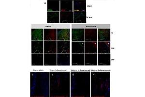 Immunostainings with CD68 and VEGF antibodies reveal an increase in expression of both markers at 3 and 7d post operation followed by a decline at d14 and d28.