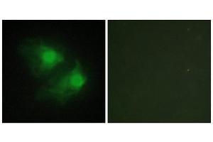 Immunofluorescence (IF) image for anti-LIM Domain Kinase 2 (LIMK2) (Internal Region) antibody (ABIN1849456) (LIMK2 anticorps  (Internal Region))