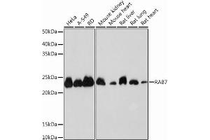 Western blot analysis of extracts of various cell lines, using R Rabbit mAb (ABIN7269812) at 1:1000 dilution. (RAB7A anticorps)