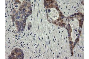 Image no. 2 for anti-RIO Kinase 2 (RIOK2) (AA 277-552) antibody (ABIN1491304) (RIOK2 anticorps  (AA 277-552))