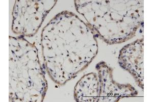 Immunoperoxidase of monoclonal antibody to FZD7 on formalin-fixed paraffin-embedded human placenta.