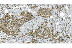 IHC analysis of LSM7 using anti-LSM7 antibody (ABIN7598937). (LSM7 anticorps  (AA 1-103))