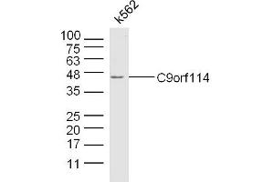 K562 lysates probed with C9orf114 Polyclonal Antibody, Unconjugated  at 1:300 dilution and 4˚C overnight incubation. (C9orf114 anticorps)