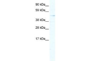WB Suggested Anti-ARX Antibody Titration:  5. (Arx anticorps  (Middle Region))