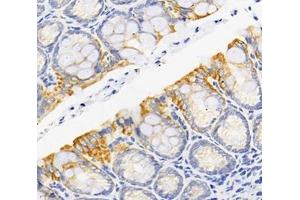 Immunohistochemistry analysis of paraffin-embedded rat colon using,RARS (ABIN7073119) at dilution of 1: 1800