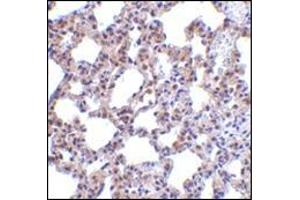 Immunohistochemistry of PKR in rat lung tissue with this product at 5 μg/ml. (EIF2AK2 anticorps  (N-Term))