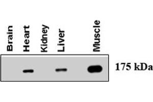 Western blot using AGL polyclonal antibody  at 1 : 500 dilution . (AGL anticorps  (AA 1479-1510))