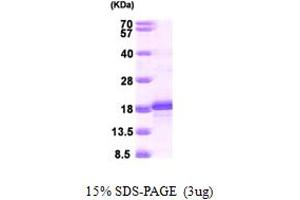 SDS-PAGE (SDS) image for Basic Leucine Zipper ATF-like Transcription Factor (BATF) (AA 1-125) protein (His tag) (ABIN667362) (BATF Protein (AA 1-125) (His tag))