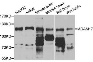 Western Blotting (WB) image for anti-ADAM Metallopeptidase Domain 17 (ADAM17) (C-Term) antibody (ABIN5663782) (ADAM17 anticorps  (C-Term))