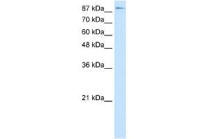 WB Suggested Anti-TCEB3 Antibody Titration:  7. (TCEB3 anticorps  (C-Term))