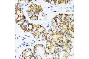 Immunohistochemistry of paraffin-embedded human stomach using CTNNA1 antibody. (CTNNA1 anticorps  (AA 637-906))