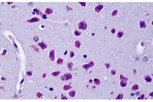 Mouse Brain: Formalin-Fixed Paraffin-Embedded (FFPE) (CYLD anticorps  (AA 364-378))
