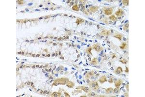 Immunohistochemistry of paraffin-embedded Human stomach using TRMT1 Polyclonal Antibody at dilution of 1:100 (40x lens). (TRMT1 anticorps)